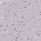 Immunohistochemical staining of human cerebral cortex shows moderate positivity in nucleoli in neurons.