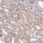Immunohistochemical staining of human kidney shows weak cytoplasmic positivity in cells in tubules.