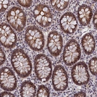 Immunohistochemical staining of human colon shows moderate positivity in nucleoli in glandular cells.