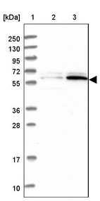 Lane 1: Marker [kDa] 250, 130, 95, 72, 55, 36, 28, 17, 10_br/_Lane 2: Human cell line RT-4_br/_Lane 3: Human cell line U-251MG sp