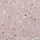 Anti-ABHD17A Antibody