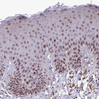 Immunohistochemical staining of human skin shows moderate to strong nuclear positivity in squamous epithelial cells.