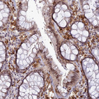 Immunohistochemical staining of human rectum shows moderate nuclear positivity in glandular cells.