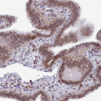 Immunohistochemical staining of human fallopian tube shows moderate nuclear positivity in glandular cells.