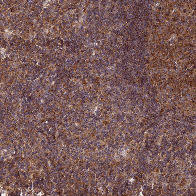 Anti-CLINT1 Antibody