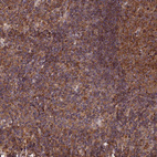 Anti-CLINT1 Antibody