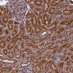 Immunohistochemical staining of human kidney shows strong cytoplasmic/ membranous positivity in cells in tubules.