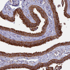 Immunohistochemical staining of human fallopian tube shows strong cytoplasmic positivity in glandular cells.