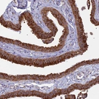Immunohistochemical staining of human fallopian tube shows strong cytoplasmic positivity in glandular cells.