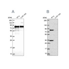 Western blot analysis using Anti-CLINT1 antibody HPA043280 (A) shows similar pattern to independent antibody HPA056947 (B).