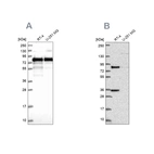Western blot analysis using Anti-CLINT1 antibody HPA043280 (A) shows similar pattern to independent antibody HPA056947 (B).