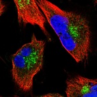 Immunofluorescent staining of human cell line U-251 MG shows localization to vesicles.