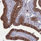 Anti-SCAMP4 Antibody