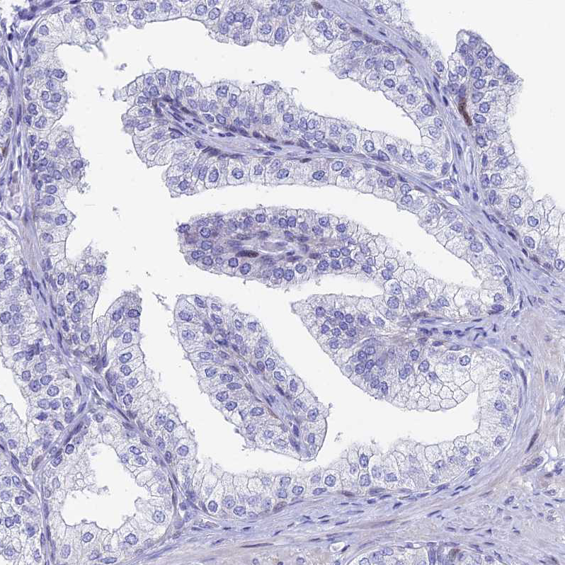 Anti-HSPA1L Antibody