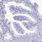 Anti-HSPA1L Antibody