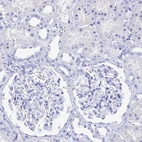Immunohistochemical staining of human kidney shows no positivity in cells in tubules as expected.
