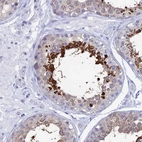 Immunohistochemical staining of human testis shows strong cytoplasmic positivity in cells in seminiferous ducts.