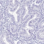 Immunohistochemical staining of human endometrium shows no positivity in glandular cells as expected.