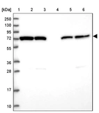 Lane 1: Marker [kDa] 250, 130, 95, 72, 55, 36, 28, 17, 10_br/_Lane 2: Human cell line RT-4_br/_Lane 3: Human cell line U-251MG sp_br/_Lane 4: Human plasma (IgG/HSA depleted)_br/_Lane 5: Human liver tissue_br/_Lane 6: Human tonsil tissue