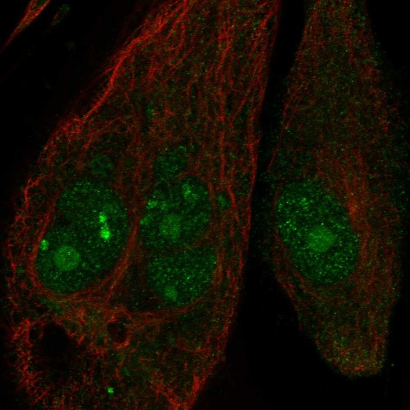 Anti-ANKRD30B Antibody