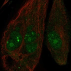 Anti-ANKRD30B Antibody