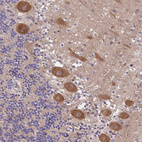 Anti-PEX16 Antibody