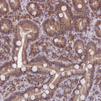 Immunohistochemical staining of human duodenum shows moderate membranous and cytoplasmic positivity in glandular cells.