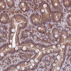 Immunohistochemical staining of human duodenum shows moderate membranous and cytoplasmic positivity in glandular cells.