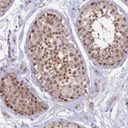 Immunohistochemical staining of human testis shows moderate membranous positivity in cells in seminiferous ducts.