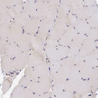 Immunohistochemical staining of human skeletal muscle shows very weak membranous positivity in myocytes.