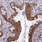 Anti-ZNF587 Antibody