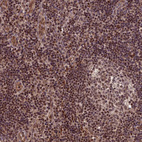 Anti-CABIN1 Antibody