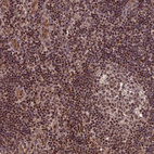 Anti-CABIN1 Antibody