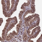 Immunohistochemical staining of human fallopian tube shows moderate nuclear positivity in glandular cells.