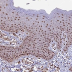 Immunohistochemical staining of human skin shows moderate nuclear positivity in squamous epithelial cells.