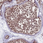 Immunohistochemical staining of human testis shows moderate nuclear positivity in cells in seminiferous ducts.