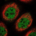 Immunofluorescent staining of human cell line A-431 shows localization to nucleoplasm & cytosol.