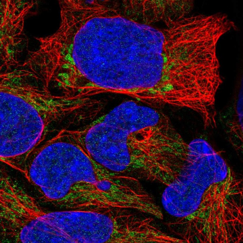 Anti-TRMU Antibody