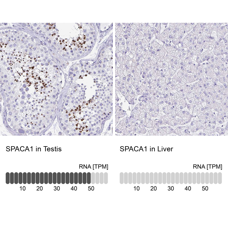 Anti-SPACA1 Antibody