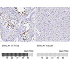 Anti-SPACA1 Antibody
