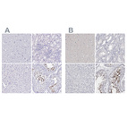 Immunohistochemical staining of human cerebral cortex, kidney, liver and testis using Anti-SPACA1 antibody HPA043297 (A) shows similar protein distribution across tissues to independent antibody HPA026744 (B).