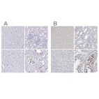 Immunohistochemical staining of human cerebral cortex, kidney, liver and testis using Anti-SPACA1 antibody HPA043297 (A) shows similar protein distribution across tissues to independent antibody HPA026744 (B).