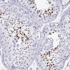 Immunohistochemical staining of human Testis shows strong cytoplasmic positivity in cells in seminiferous ducts.