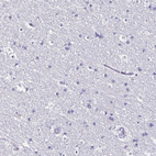 Immunohistochemical staining of human Cerebral cortex shows no positivity in neuronal cells as expected.