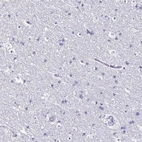 Immunohistochemical staining of human Cerebral cortex shows no positivity in neuronal cells as expected.