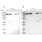 Western blot analysis using Anti-SEC23IP antibody HPA043305 (A) shows similar pattern to independent antibody HPA038403 (B).