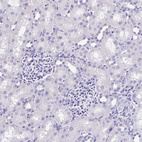 Immunohistochemical staining of human Kidney shows no positivity in cells in tubules as expected.