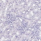 Immunohistochemical staining of human Kidney shows no positivity in cells in tubules as expected.