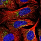 Immunofluorescent staining of human cell line U-2 OS shows localization to vesicles.