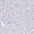 Immunohistochemical staining of human Liver shows no positivity in hepatocytes as expected.